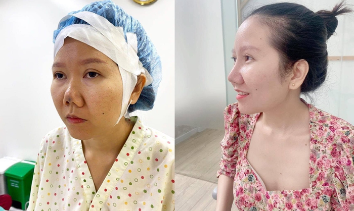Bác sĩ Hồ Phi Nhạn – 'Khắc tinh' của những chiếc mũi hỏng Ảnh 4