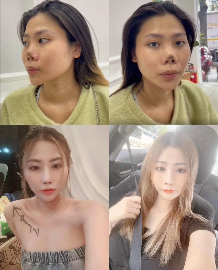 Bác sĩ Hồ Phi Nhạn – 'Khắc tinh' của những chiếc mũi hỏng Ảnh 2
