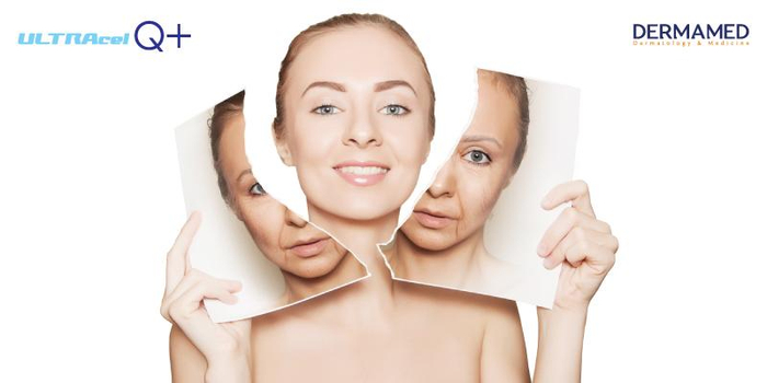 HIFU tuyến tính Ultracel Q - thế hệ nâng cơ trẻ hóa tiếp theo