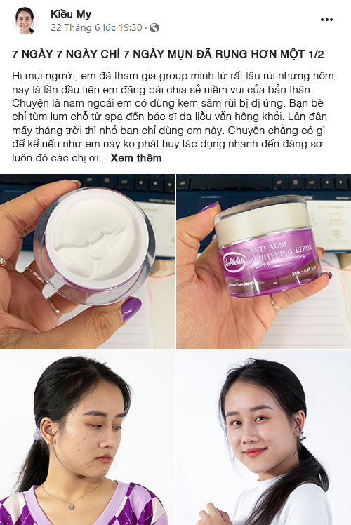 Facebook-er K.M thu hút cư dân mạng bằng bài viết chia sẻ quá trình thoát mụn