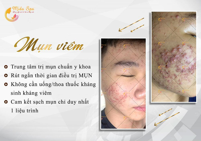 Midu Spa - Trung tâm chăm sóc da thẩm mỹ công nghệ cao Ảnh 3