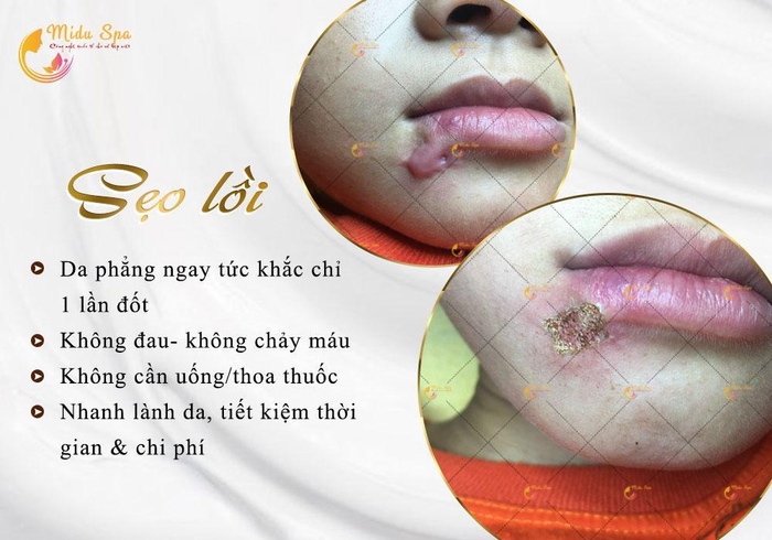 Midu Spa - Trung tâm chăm sóc da thẩm mỹ công nghệ cao Ảnh 2