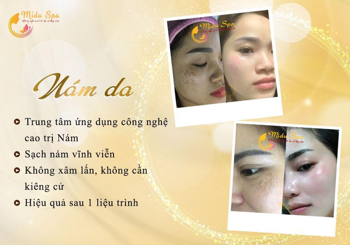 Midu Spa - Trung tâm chăm sóc da thẩm mỹ công nghệ cao Ảnh 5