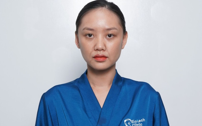 Xóa sạch nếp nhăn, gương mặt căng mịn nhờ công nghệ Mô sinh học Bio MaxFace Ảnh 2