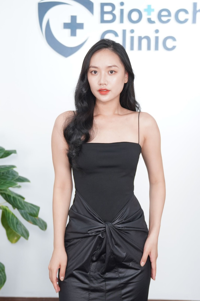 Gương mặt đầy đặn trẻ trung như thuở đôi mươi nhờ công nghệ Mô sinh học Bio MaxFace