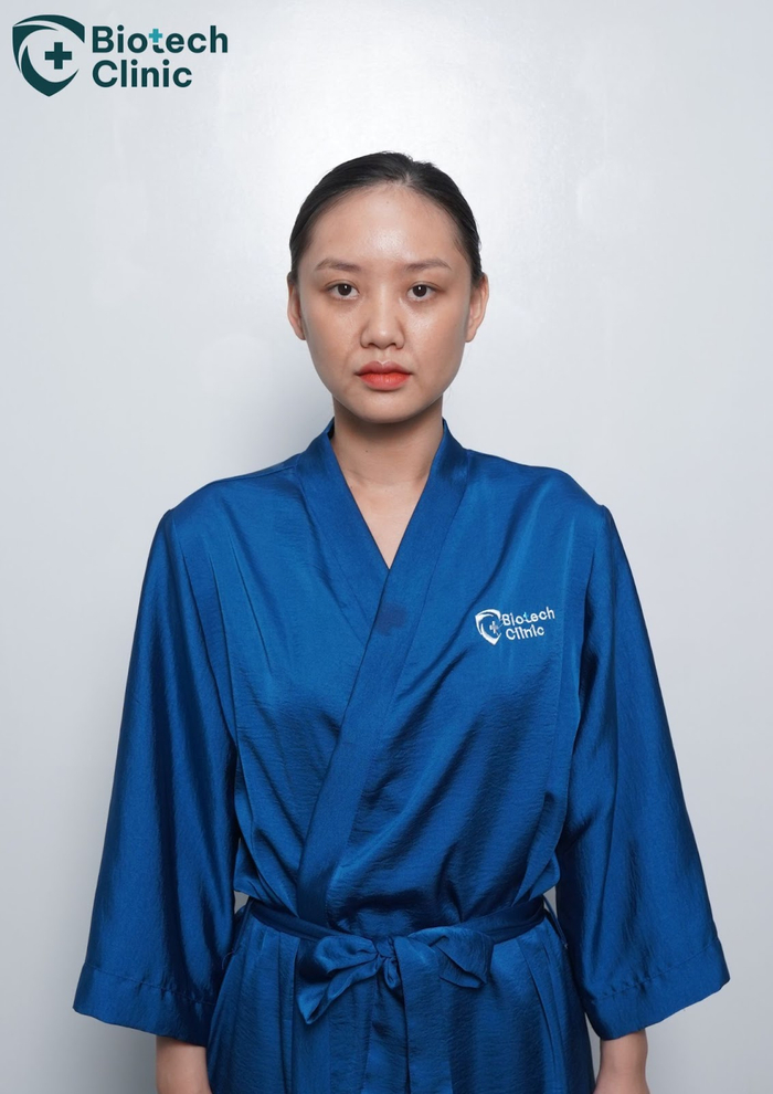 Gương mặt hốc hác, rãnh cười sâu của chị Nga sau khi sinh con xong