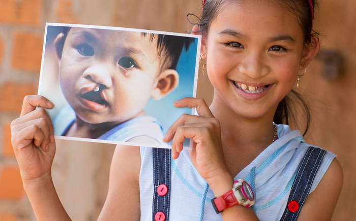 Corine de Farme kết hợp cùng tổ chức Operation Smile 'lan tỏa nụ cười trẻ thơ' Ảnh 2