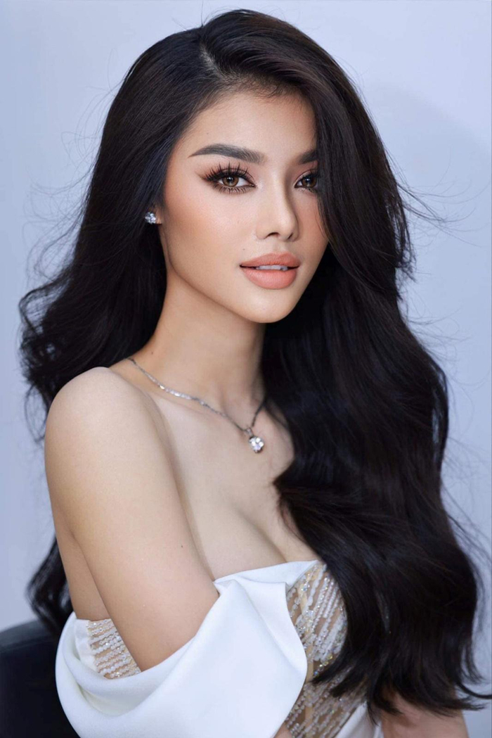 Á hậu Kiều Loan sau sửa mũi 1 tuần.