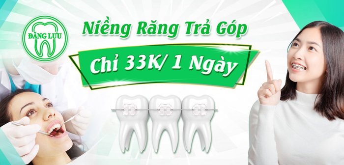 Bạn Hữu Vương đã thay đổi diện mạo nhờ niềng răng chỉ với 33K/ngày
