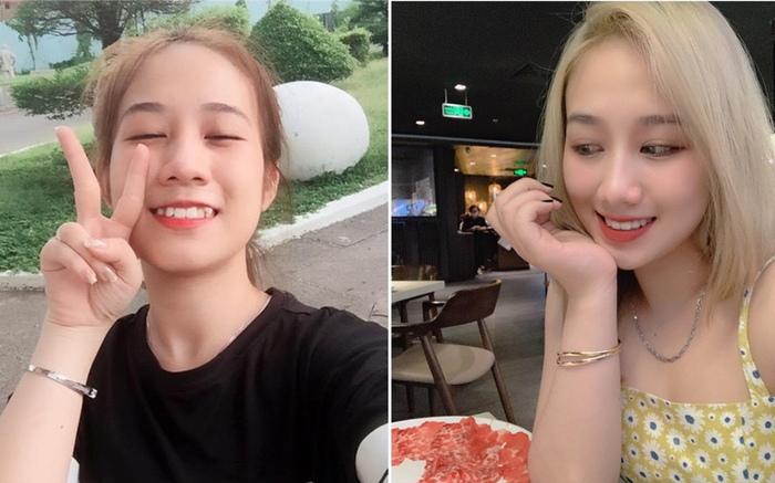 Niềng răng – khoản đầu tư khôn ngoan cho sức khỏe và vẻ ngoài của bạn Ảnh 2