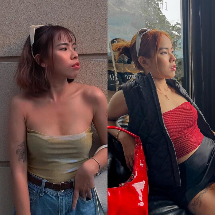 Bạn Yến Linh tự tin và vui vẻ hơn sau khi niềng răng